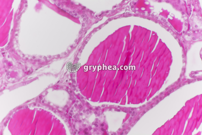 Thyroïde en hypo-activité x100 - gryphea.com